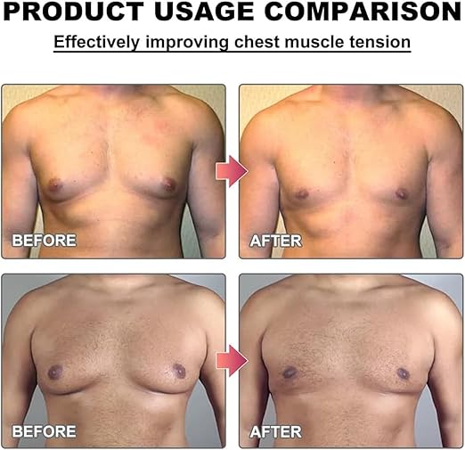 Men Therm Bee Venom Gynecomastia Heating Oil (Original) - زيت التدفئة Men Therm Bee Venom Gynecomastia (الأصلي)